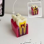 Educational Tooth Decay