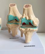 Knee Joint Model - Image 4