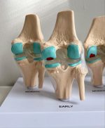 Knee Joint Model - Image 2