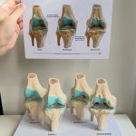 Knee Joint Model