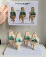 Knee Joint Model