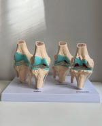 Knee Joint Model - Image 3