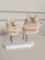 Teeth Dentition Stages - Image 2