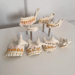 Teeth Dentition Stages