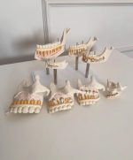 Teeth Dentition Stages