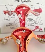 Uterus Model - Image 3