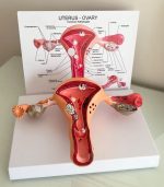 Uterus Model - Image 2