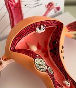Uterus Model - Image 4