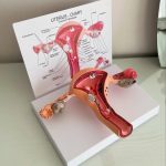 Uterus Model