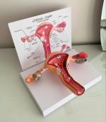 Uterus Model